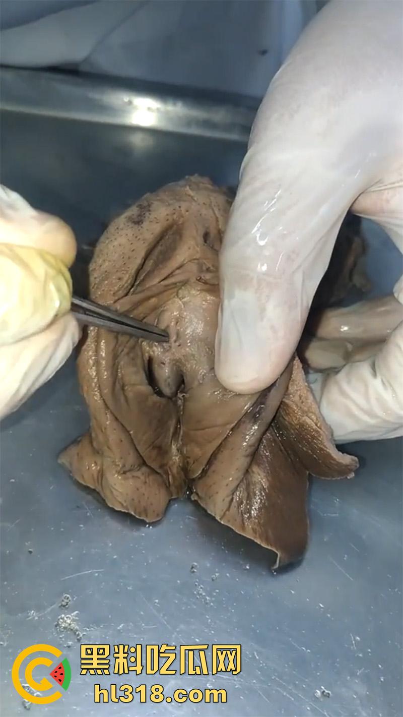 真实西藏密宗法器“肉莲花”，少女被108罗汉轮奸后，五毒侵蚀九蒸九炼，活体切割才可肉莲大成！-4