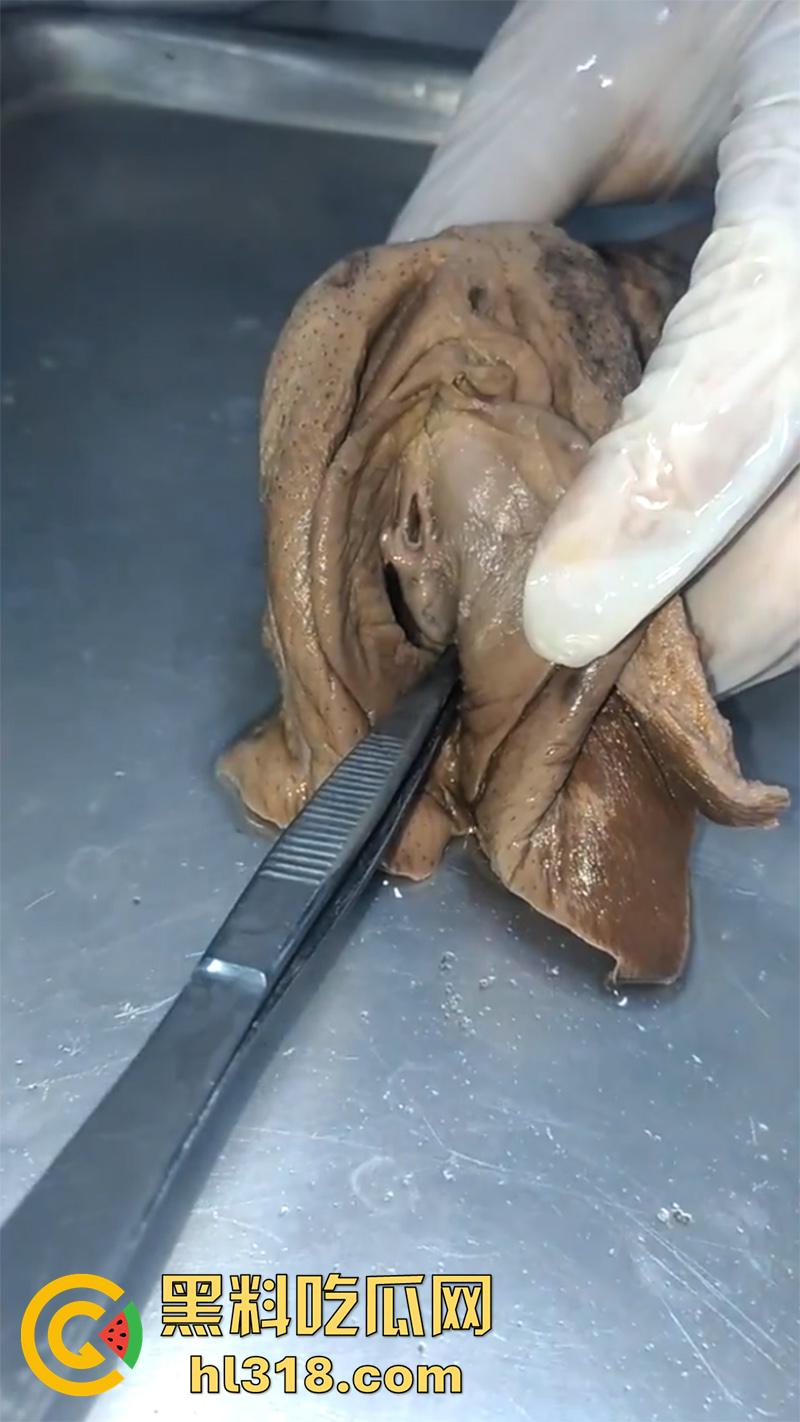 真实西藏密宗法器“肉莲花”，少女被108罗汉轮奸后，五毒侵蚀九蒸九炼，活体切割才可肉莲大成！-5